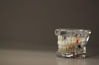 Scientists Develop Material Capable of Regenerating Dental Enamel