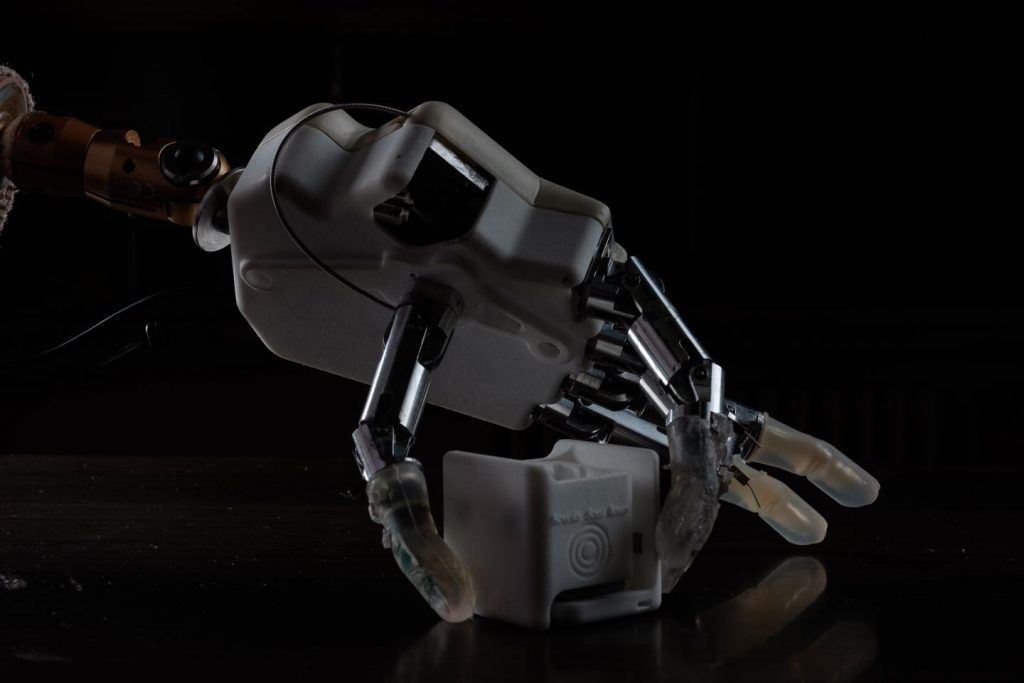 A prosthetic that restores the sense of where your hand is