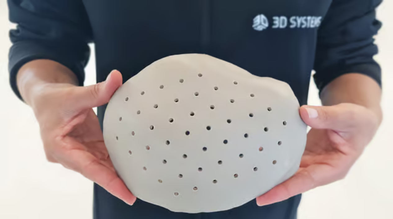 peek cranial implant - 3D printed