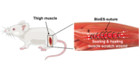 Smart Stitches Help Faster Healing When Moving